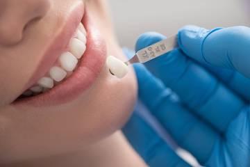 Close up of patient getting veneers in Lakeland, FL