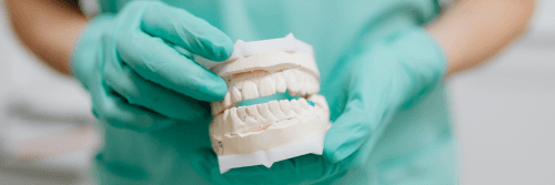 Dental professional wearing gloves holding a full dental model with upper and lower teeth.