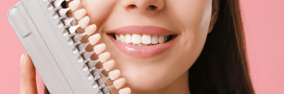 dental teeth color guide in Lakeland