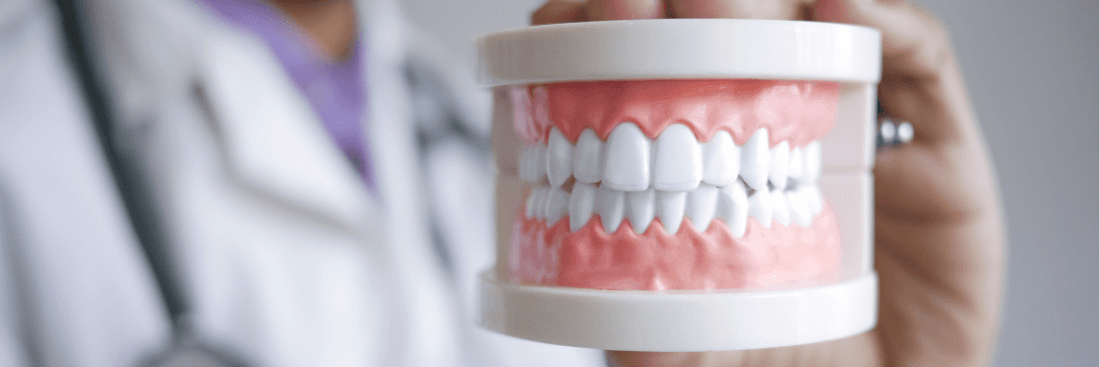 Denture model held by a dentist in Lakeland