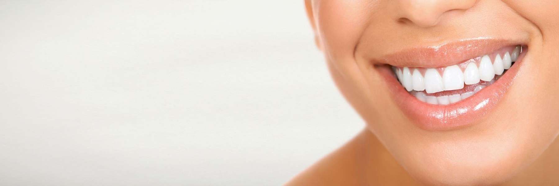Woman's full set of white teeth in Lakeland, FL