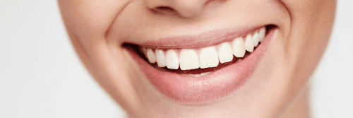 A close-up of a person smiling with clean, white teeth.