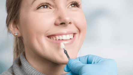 Getting ready for a brighter smile with custom-made dental veneers.