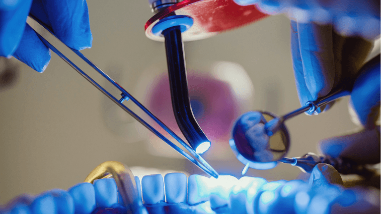 Dental curing light during procedure in Lakeland