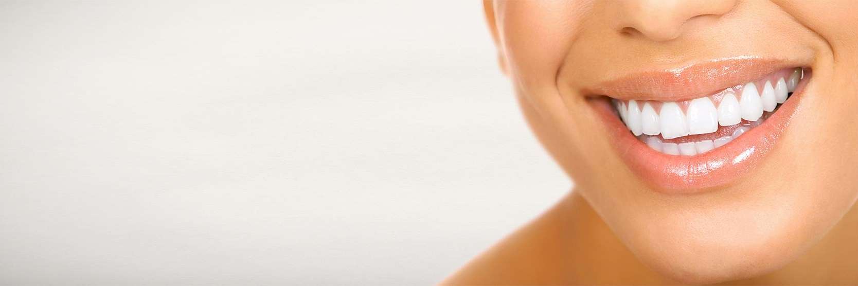 Close up of patient's teeth after smile makeover in Lakeland, FL
