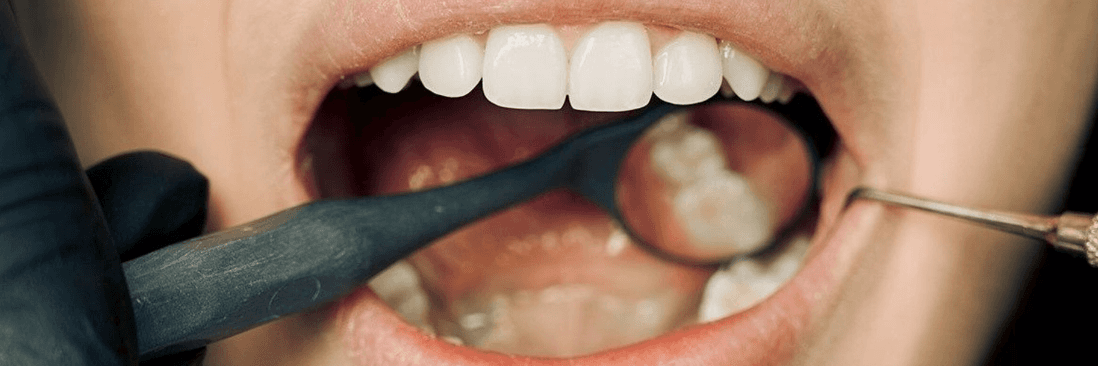 dental checkup procedure in Lakeland